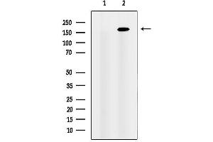 anti-Centrosomal Protein 164kDa (CEP164) (C-Term) antibody