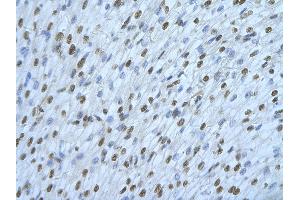 Rabbit Anti-HNRNPDL Antibody       Paraffin Embedded Tissue:  Human cardiac cell   Cellular Data:  Epithelial cells of renal tubule  Antibody Concentration:   4.