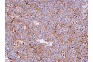 IHC-P Image Immunohistochemical analysis of paraffin-embedded PC13 xenograft, using Calpain 1, antibody at 1:500 dilution. (CAPN1 抗体)
