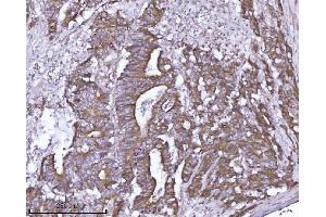 IHC analysis of ABP1/AOC1 using anti-ABP1/AOC1 antibody (ABIN7600040). (DAO 抗体  (AA 140-180))
