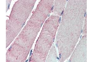 IHC testing of FFPE human skeletal muscle tissue with OSBPL1A antibody at 5ug/ml. (OSBPL1A 抗体)