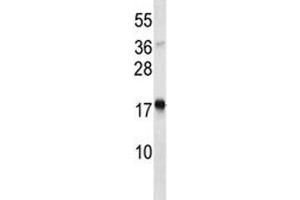 TSLP antibody western blot analysis in Jurkat lysate. (Thymic Stromal Lymphopoietin 抗体  (AA 101-130))