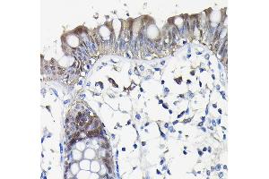 Immunohistochemistry of paraffin-embedded human colon using Galectin 3/Galectin 3/LG Rabbit pAb (ABIN7267338) at dilution of 1:100 (40x lens). (Galectin 3 抗体  (AA 1-250))