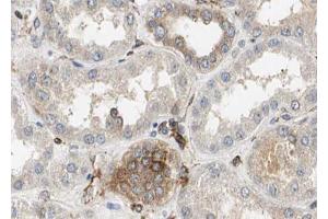ABIN6272896 at 1/100 staining Mouse kidney tissue by IHC-P. (TIMM23 抗体  (N-Term))