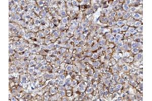 IHC analysis of EGFR using anti-EGFR antibody (ABIN7601478). (EGFR 抗体  (AA 36-497))