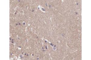 ABIN6266548 at 1/200 staining human brain tissue sections by IHC-P. (Metabotropic Glutamate Receptor 4 抗体  (C-Term))