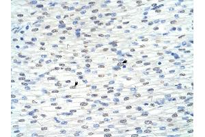 RNF8 antibody was used for immunohistochemistry at a concentration of 4-8 ug/ml to stain Myocardial cells (arrows) in Human Heart. (RNF8 抗体  (C-Term))
