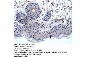 Human Skin (ZNF660 抗体  (C-Term))