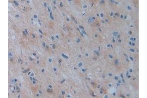 Immunohistochemistry (IHC) image for anti-phosphoserine Aminotransferase 1 (PSAT1) (AA 1-312) antibody (ABIN7435646)
