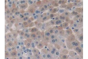DAB staining on IHC-P; Samples: Mouse Liver Tissue (ACVR2B 抗体  (AA 214-350))