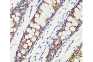 Immunohistochemistry of paraffin-embedded Human colon using TOM20 Polyclonal Antibody at dilution of 1:100 (40x lens). (TOMM20 抗体)