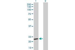 Western Blot analysis of BAG2 expression in transfected 293T cell line by BAG2 MaxPab polyclonal antibody. (BAG2 抗体  (AA 1-211))