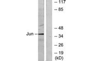 Western blot analysis of extracts from HeLa cells, using c-Jun (Ab-91) Antibody. (C-JUN 抗体  (AA 58-107))