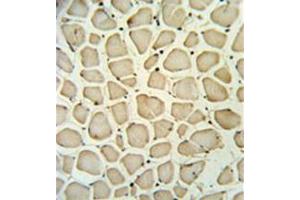 Immunohistochemistry analysis in formalin fixed and paraffin embedded skeletal muscle reacted with PGP Antibody (N-term) followed which was peroxidase conjugated to the secondary antibody and followed by DAB staining. (PGP 抗体  (N-Term))