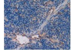 Detection of TM in Mouse Spleen Tissue using Polyclonal Antibody to Thrombomodulin (TM) (Thrombomodulin 抗体  (AA 31-167))