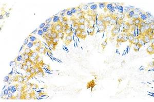 Immunohistochemistry of paraffin-embedded Rat testis using TAPBP Polyclonal Antibody at dilution of 1:200 (40x lens). (TAPBP 抗体)