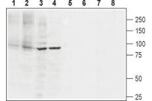 Western blot analysis of rat heart membranes (lanes 1 and 5), mouse heart membranes (lanes 2 and 6), rat PC12 pheochromocytoma cell line lysate (lanes 3 and 7) and human Jurkat T cell leukemia cell line lysate (lanes 4 and 8): - 1-4. (ATP2A2 抗体  (2nd Cytoplasmic Loop))