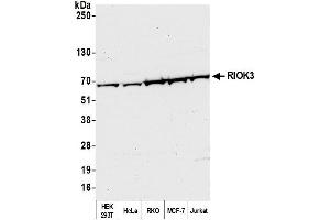 anti-RRIO Kinase 3 (RIOK3) (AA 469-519) antibody