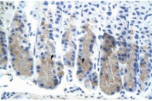 Immunohistochemistry (IHC) image for anti-E74-Like Factor 3 (Ets Domain Transcription Factor, Epithelial-Specific) (ELF3) (N-Term) antibody (ABIN2779832)