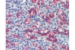 Immunohistochemistry (IHC) image for anti-Zinc Finger Protein 71 (ZNF71) (Middle Region) antibody (ABIN2781150)