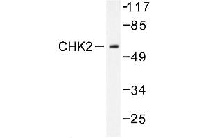 Image no. 1 for anti-Checkpoint Kinase 2 (CHEK2) (pSer379) antibody (ABIN272011) (CHEK2 抗体  (pSer379))