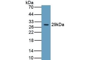Detection of Recombinant ITGb6, Human using Monoclonal Antibody to Integrin Beta 6 (ITGb6) (ITGB6 抗体  (AA 131-371))