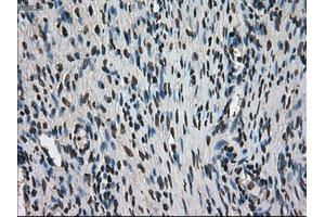 Immunohistochemistry (IHC) image for anti-Antigen Identified By Monoclonal Antibody Ki-67 (MKI67) (AA 1-250) antibody (ABIN2724155)