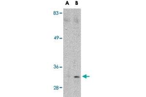 Western blot analysis of MARCH8 in HeLa cell lysate with MARCH8 polyclonal antibody  at (A) 0. (MARCH8 抗体  (C-Term))
