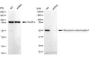 Western blotting analysis using karyopherin subunit alpha 2 antibody (ABIN7800945). (Recombinant Importin Subunit alpha-1 (KPNA2) 抗体)