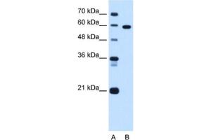 Western Blotting (WB) image for anti-T-Box 15 (TBX15) antibody (ABIN2463095) (T-Box 15 抗体)