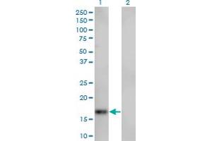 Western Blot analysis of SPIRE1 expression in transfected 293T cell line by SPIRE1 monoclonal antibody (M01), clone 4C5. (SPIRE1 抗体  (AA 482-583))