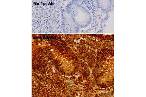 Immunohistochemistry (IHC) image for anti-Protein Disulfide Isomerase Family A, Member 3 (PDIA3) (C-Term) antibody (ABIN1440039)