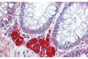 Detection of HEXb in Human Colon Tissue using Polyclonal Antibody to Hexosaminidase B Beta (HEXb) (HEXB 抗体  (AA 122-311))