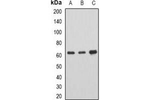 Western blot analysis of AHCYL1 expression in SKOV3 (A), mouse brain (B), rat spinal cord (C) whole cell lysates. (AHCYL1 抗体)