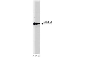 Western Blotting (WB) image for anti-Protein Kinase, CAMP-Dependent, Regulatory, Type II, beta (PRKAR2B) (AA 1-418) antibody (ABIN968073) (PRKAR2B 抗体  (AA 1-418))