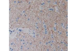 Used in DAB staining on fromalin fixed paraffin- embedded Kidney tissue (Neurotrypsin 抗体  (AA 17-235))