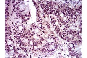 Immunohistochemistry (IHC) image for anti-T Antigen (AA 257-309) antibody (ABIN1845736) (T Antigen (AA 257-309) 抗体)