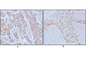 Immunohistochemical analysis of paraffin-embedded human breast cancer,Lung breast tissues using EGF mouse mAb (EGF 抗体)
