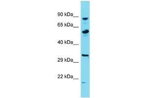 Host:  Rabbit  Target Name:  KHSRP  Sample Type:  Thyroid Tumor lysates  Antibody Dilution:  1. (KHSRP 抗体  (Middle Region))