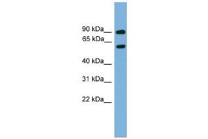 WB Suggested Anti-Nab2 Antibody Titration:  0. (NAB2 抗体  (Middle Region))