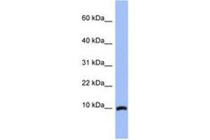 Image no. 1 for anti-Acyl-CoA Binding Domain Containing 7 (ACBD7) (N-Term) antibody (ABIN6744031) (ACBD7 抗体  (N-Term))