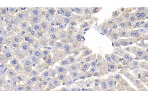 Detection of CP in Rat Liver Tissue using Polyclonal Antibody to Ceruloplasmin (CP) (Ceruloplasmin 抗体  (AA 872-1059))