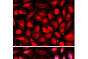 Immunofluorescence analysis of U2OS cells using ETS1 Polyclonal Antibody (ETS1 抗体)