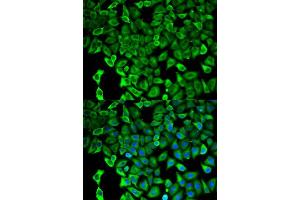 Immunofluorescence (IF) image for anti-Proteasome (Prosome, Macropain) 26S Subunit, Non-ATPase, 2 (PSMD2) (AA 1-260) antibody (ABIN3015813)