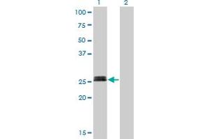 Western Blot analysis of MYOG expression in transfected 293T cell line by MYOG monoclonal antibody (M01), clone 2B7. (Myogenin 抗体  (AA 1-224))