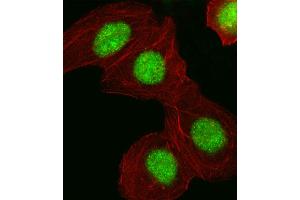 Fluorescent image of A549 cell stained with HMGA1 Antibody . (HMGA1 抗体  (C-Term))