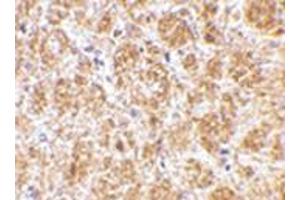 Immunohistochemistry of DARC in mouse brain tissue with DARC antibody at 2. (DARC 抗体  (C-Term))