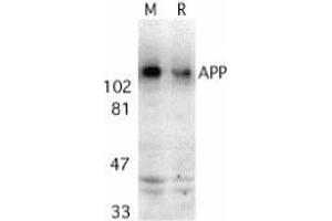 Western blot analysis of APP in mouse (M) and rat (R) brain tissue lysates with AP30071PU-N APP antibody at 2 μg/ml. (APP 抗体  (C-Term))