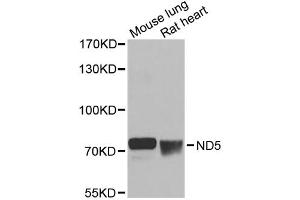 Western blot analysis of extracts of various cell lines, using ND5 antibody (ABIN6294088) at 1:1000 dilution. (MT-ND5 抗体)