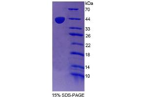 SDS-PAGE analysis of Human TR2 Protein. (NR2C1 蛋白)